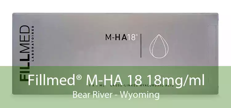 Fillmed® M-HA 18 18mg/ml Bear River - Wyoming